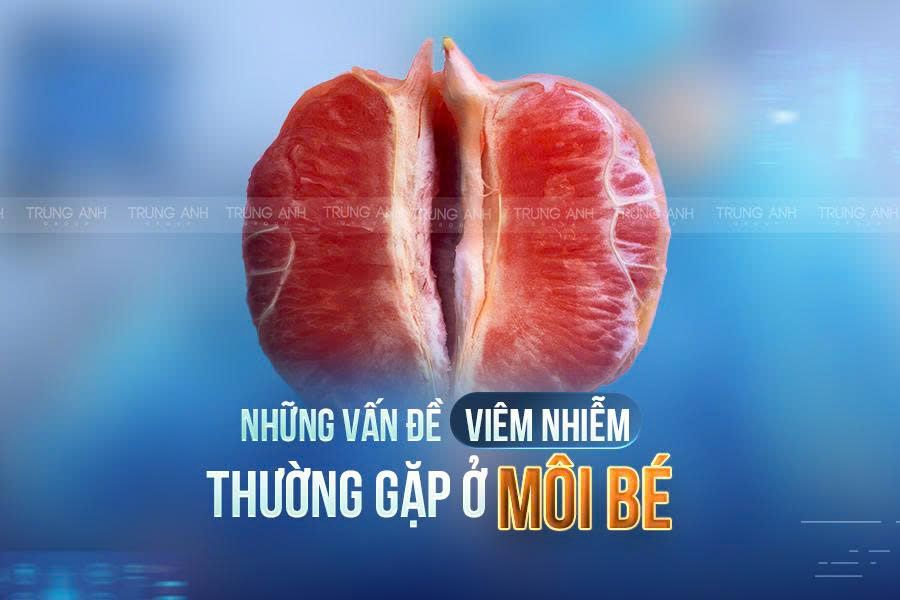 Những vấn đề viêm nhiễm thường gặp ở môi bé