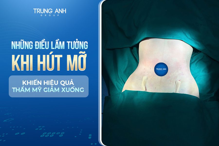 Những điều lầm tưởng khi hút mỡ khiến hiệu quả thẩm mỹ giảm xuống