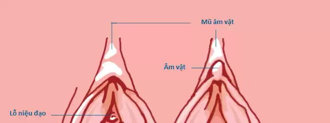Thăng hoa cảm xúc yêu nhờ phương pháp chỉnh mũ âm vật