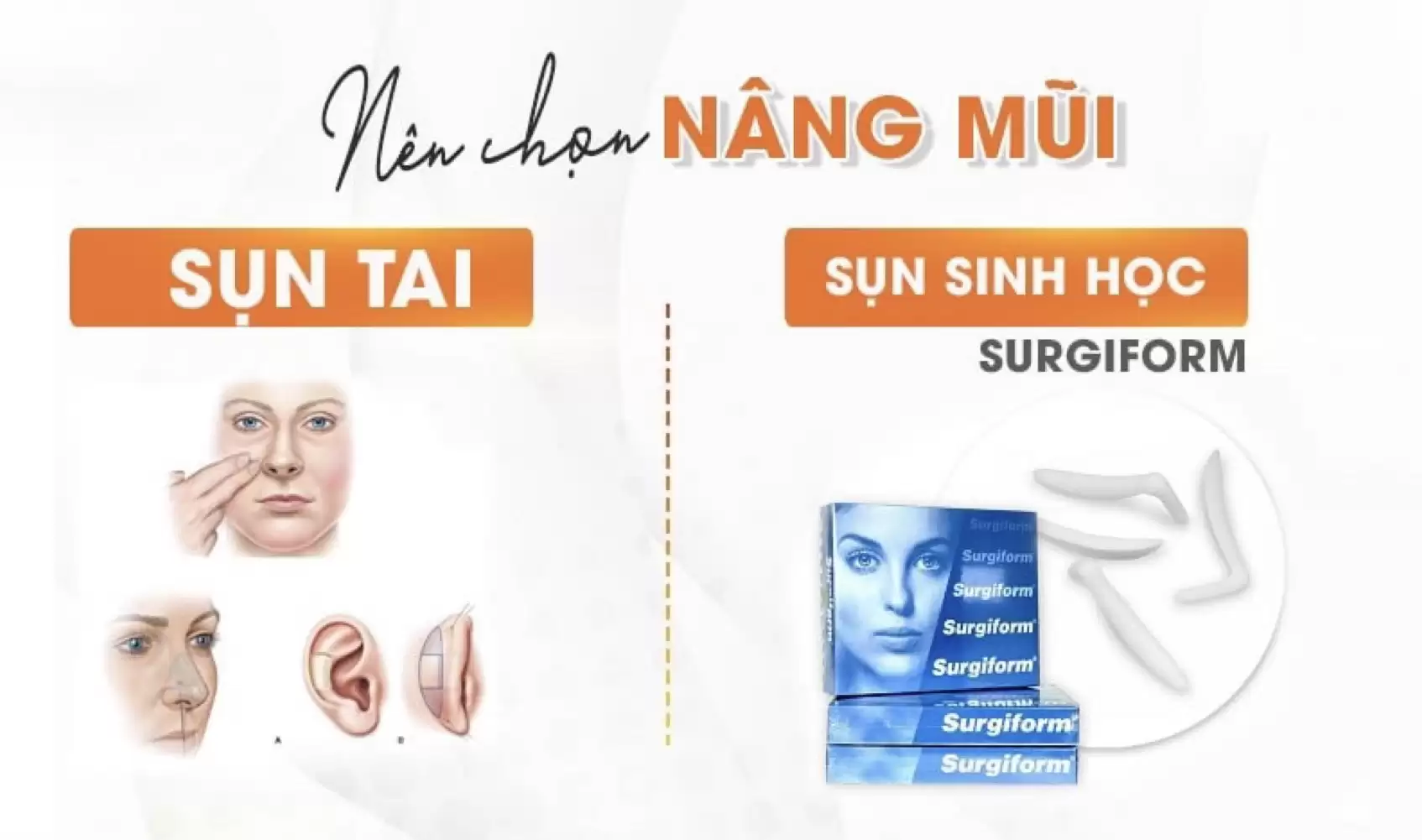 Nâng mũi sụn tai hay sụn sinh học surgiform tốt hơn?