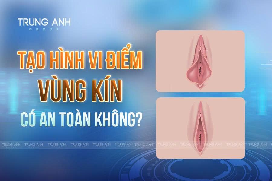 Tạo hình vi điểm vùng kín có an toàn không?