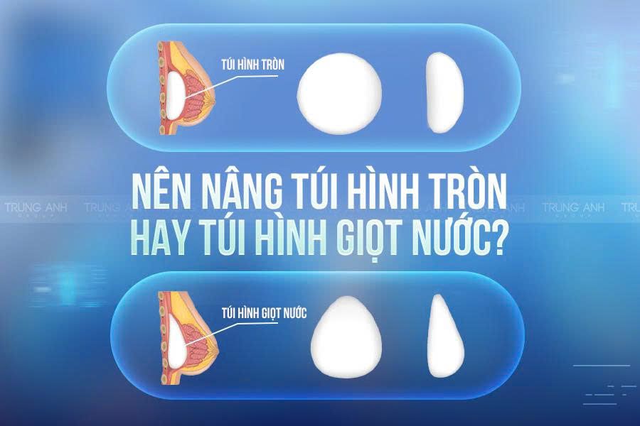 Nên nâng ngực túi hình tròn hay túi hình giọt nước