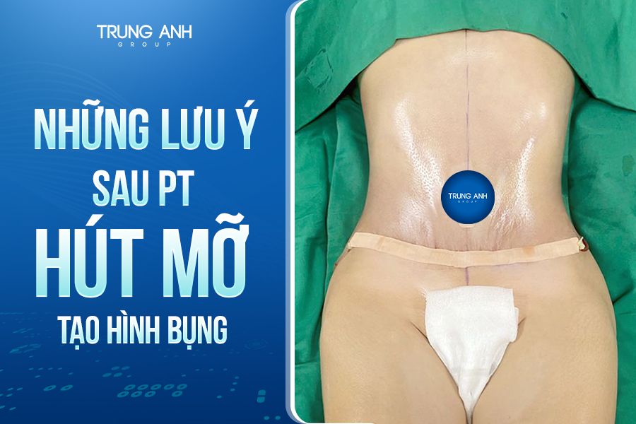 Những lưu ý sau phẫu thuật hút mỡ tạo hình thành bụng