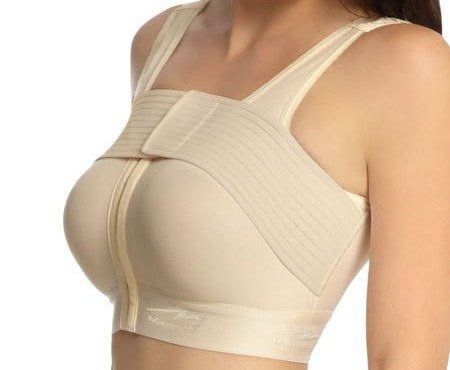 Sau nâng ngực có cần mặc áo định hình hay không?