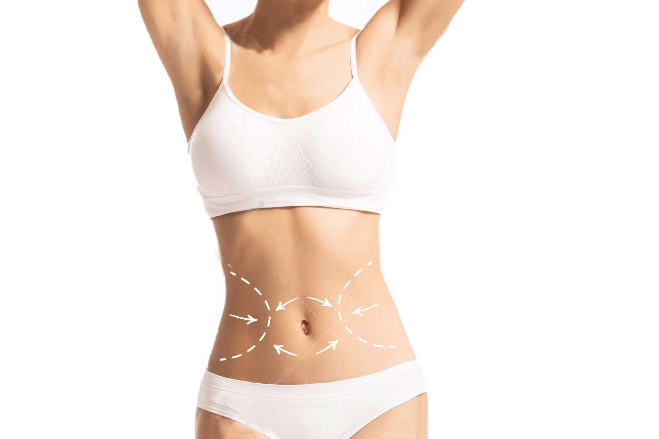 Điểm danh những phương pháp phẫu thuật thành bụng phổ biến