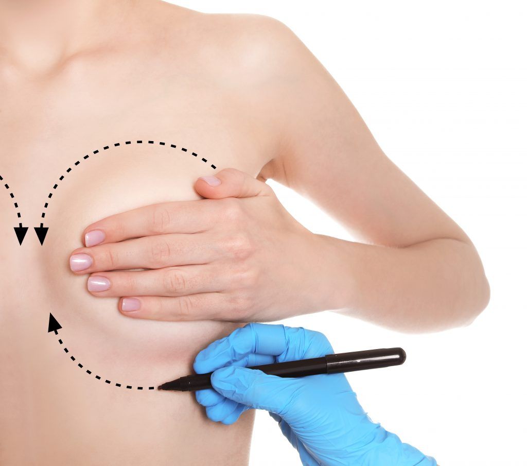 Lưu ý những triệu chứng bình thường và không bình thường sau phẫu thuật nâng ngực