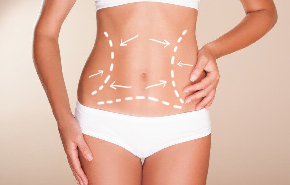 Những điều cần biết về công nghệ hút mỡ Body Jet