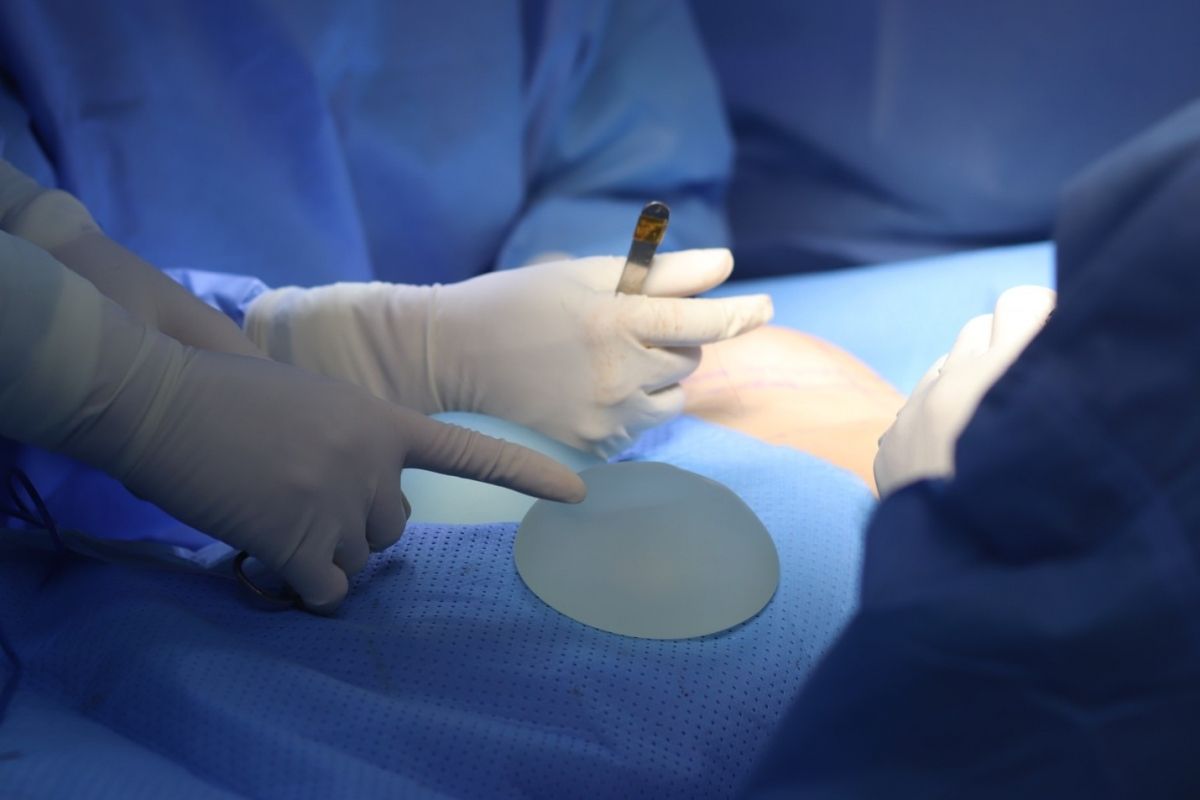 Quy trình nâng ngực được các bác sĩ tiến hành như thế nào?