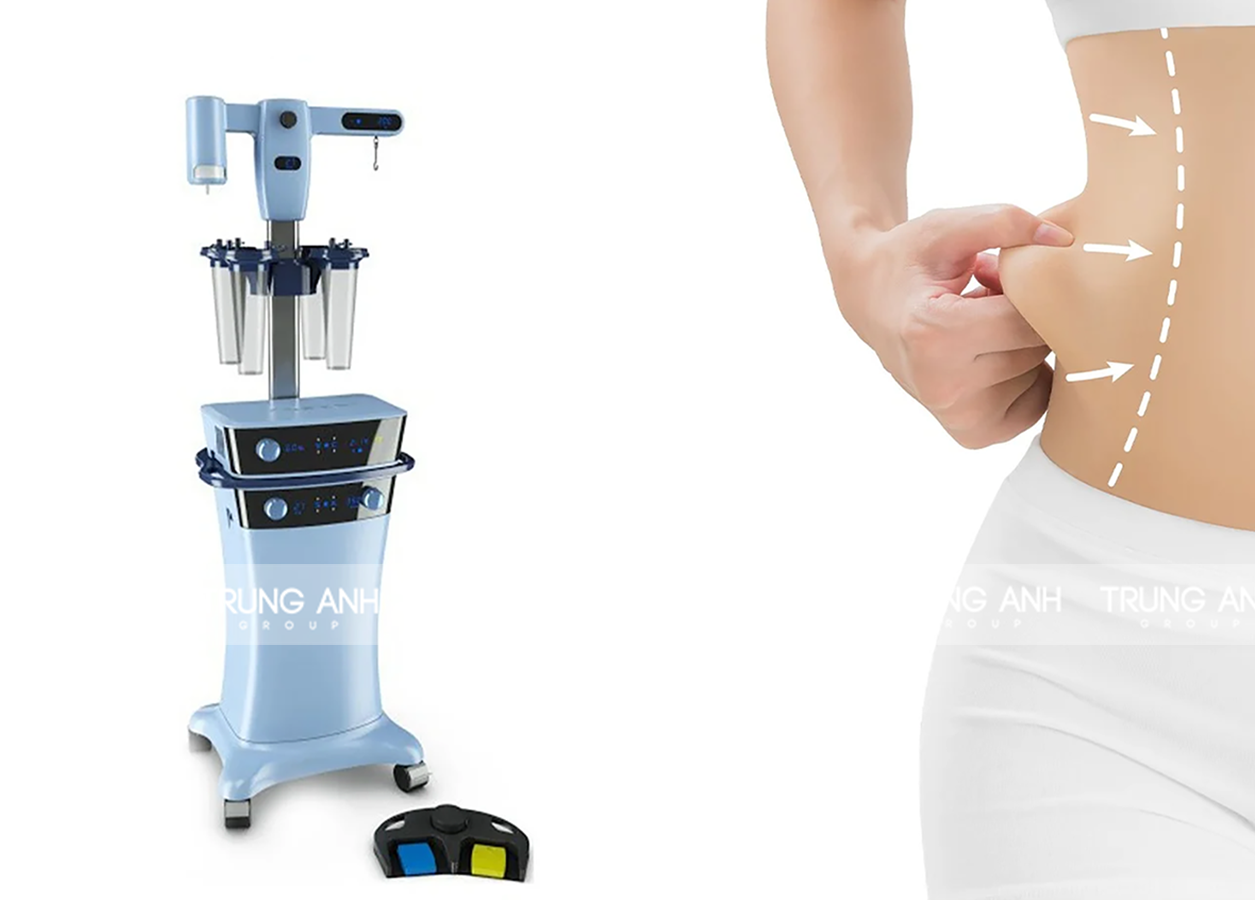 Hút mỡ công nghệ Vaser Lipo