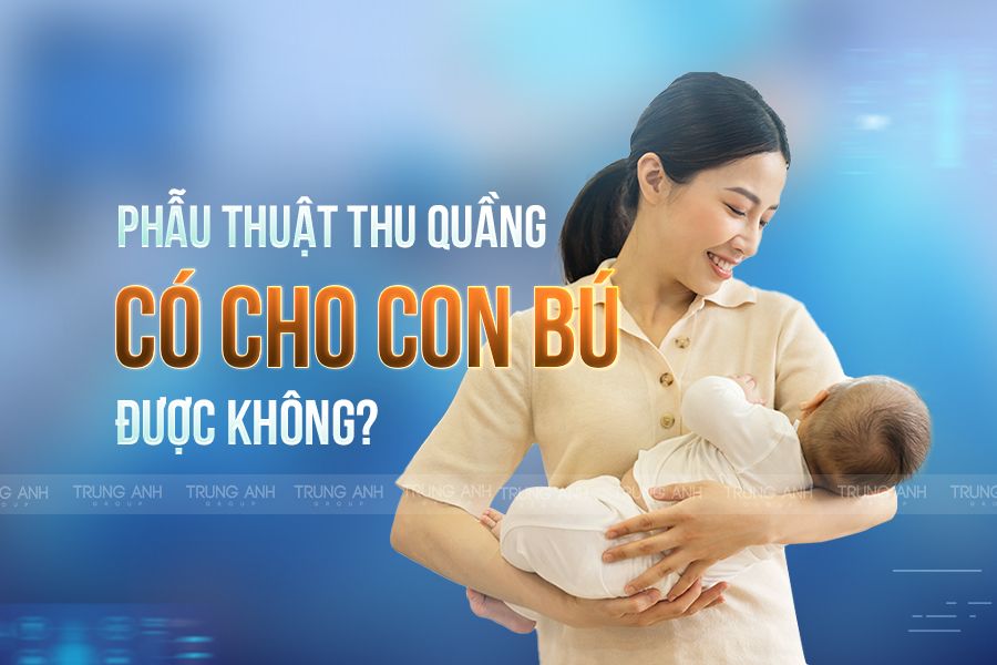 Phẫu thuật thu quầng có cho con bú được không?