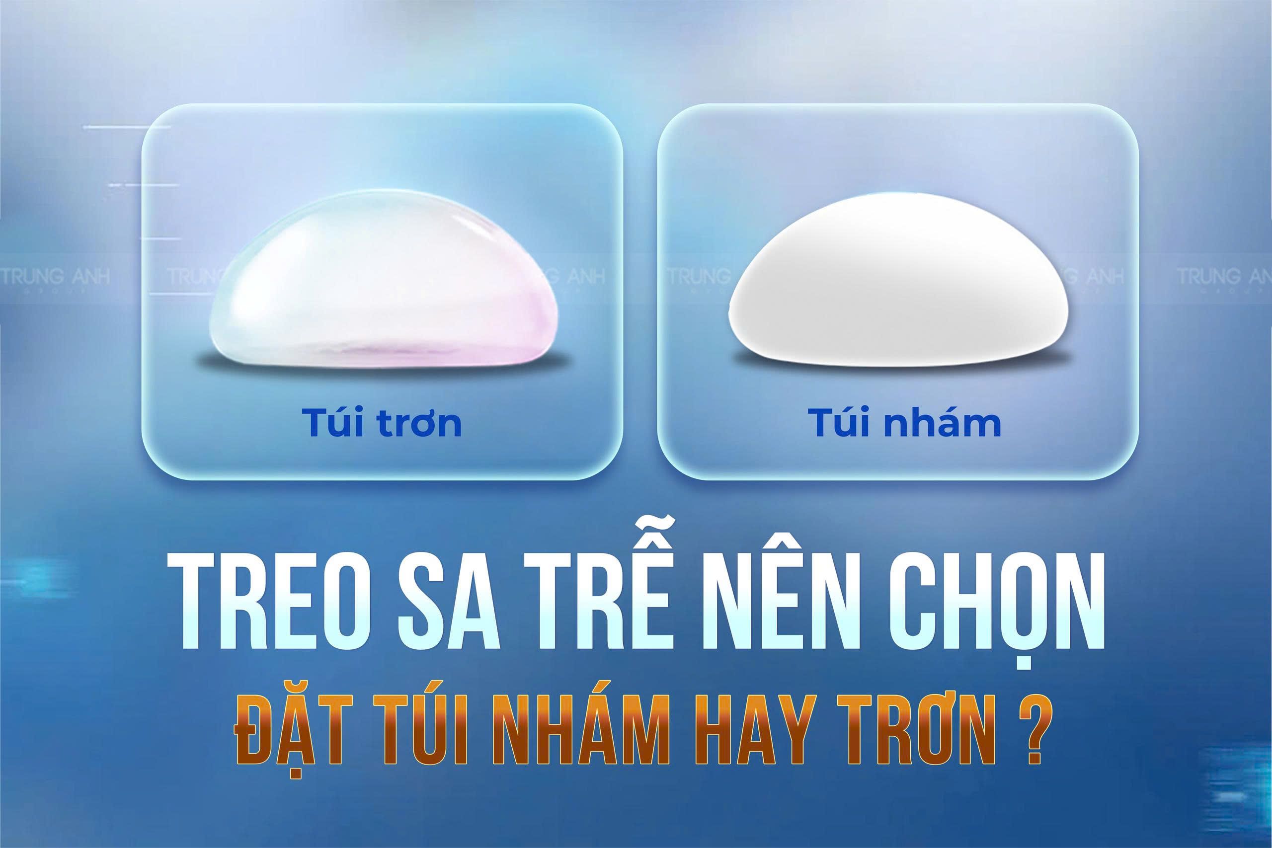 Treo sa trễ nên chọn đặt túi nhám hay trơn?